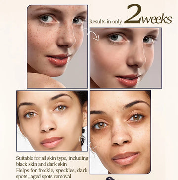 Korean Brightening Cream for Dark Spots & Even Tone