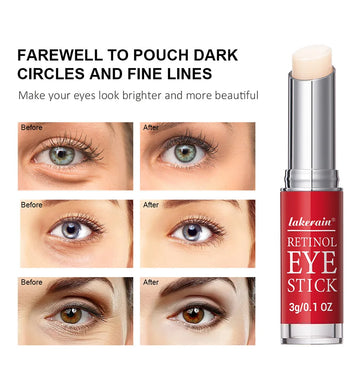 Retinol Eye Cream Lightening Dark Circles Firming Skin Instant Eye Repair Serum Stick for women Women Eyes Care